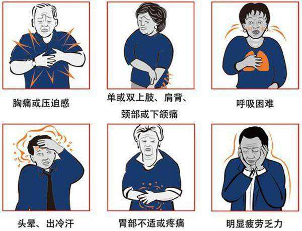 突发心脏病如何救助？ 的插图-1